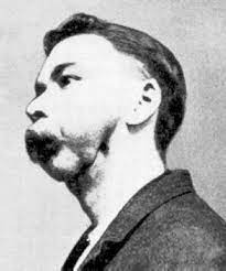 We did not find results for: Phossy Jaw Wikipedia