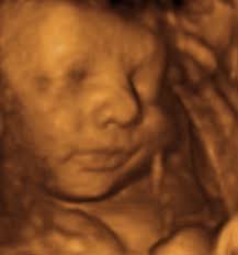 Now Showing 3D4D Ultrasounds