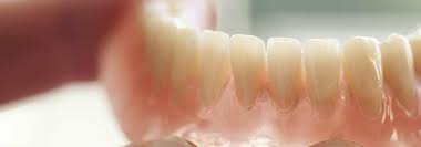Yes, it depends on the dentist proposal/plan. Dentures A Guide To Types Of False Teeth Their Costs Electric Teeth