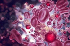 Image result for Hematologic Cancer