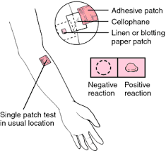 Image result for Patch Testing