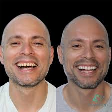 Team Dent Peru🦷‎‏ (@‏‎teamdentperu‎‏) • Instagram تصاویر اور ویڈیوز