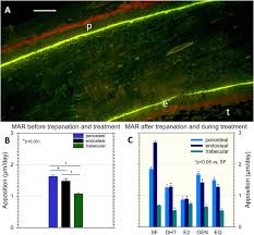 Review of long bone anatomy: Effect Of Dihydrotestosterone 17 B Estrogen Genistein And Equol On Remodeling And Morphology Of Bone In Osteoporotic Male Rats During Bone Healing Sciencedirect