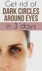 Get Rid Of Dark Circles Around Eyes In 3 Days My Beauty Tips For You Dark Circles Around Eyes Dark Eye Circles Dark Circles Under Eyes