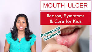 Maybe you would like to learn more about one of these? How To Cure Regular Mouth Ulcer In Kids Reasons Home Remedies Youtube