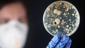 Zakażenia bakterią potocznie nazywaną new delhi notowane są w polsce od 2011 roku, ale od 2015 roku liczba zarażonych nią pacjentów wzrasta. Epidemia Superbakterii W Polsce Objawy New Delhi O Tym Sie Mowi Polki Pl