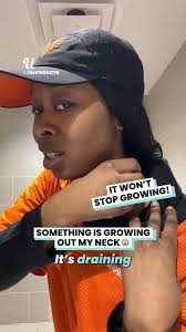 It’s getting bigger… and no one knows why 😱