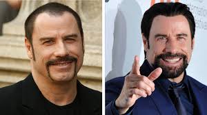 Wenn die haare licht werden und die kopfhaut sänger sasha hat sich im sommer 2014 haare transplantieren lassen und das ebenfalls öffentlich. Christoph Metzelder Hat Jetzt Volleres Haar Haartransplantation Diese Promis Haben Die Frisur Getuned Bayern 3