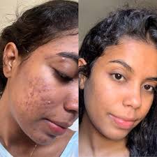 Instagram photo by Gema Herrera ( la piel ) • Jan 17, 2024 at 10:02 AM