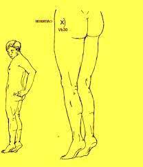 Imagen Relacionada Nervio Ciatico Nervio Dolor De Ciatica