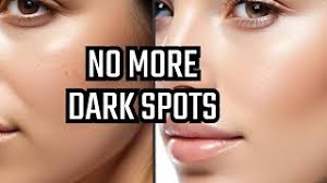 Mandelic Acid Peel 22%