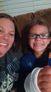 One year ago: Avery's broken arm