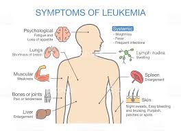 Common Symptoms And Signs Of Leukemia Medical Illustration Ideal For Leukemia Symptoms Leukemia Parkinsons Disease