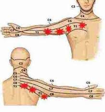 Pin On Pain In The Hip