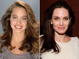 The actress has never confirmed that she's gotten a nose job, but multiple plastic surgeons have said that it looks like she's had a rhinoplasty . Did Angelina Jolie Get A Nose Job In Touch Weekly