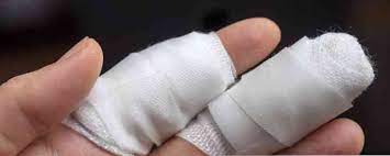 Nasihat ini selalu saya pegang, setiap dekat dengan lawan jenis saya tanyakan tujuannya apa, menikah atau sekadar pacaran saja. Bolehkah Tangan Patah Dihubungkan Semula Maklumat Kesihatan Petua Perubatan Dan Maklumat Kesihatan Yang Berguna