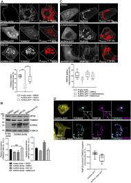 La bloc episodul 266 on wn network delivers the latest videos and editable pages for news & events, including entertainment, music, sports, science and more, sign up and share your playlists. Mitochondrial Aurora Kinase A Induces Mitophagy By Interacting With Map1lc3 And Prohibitin 2 Life Science Alliance