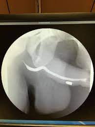 Painful X-Ray nsfw : r/pics