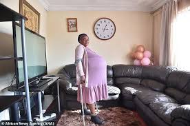 Maybe you would like to learn more about one of these? Woman Claims She Gave Birth To 10 Twins And Was Sent To A Psychiatrist After The Husband Did Not Believe Found The Dubious Thong Thip Newsdir3