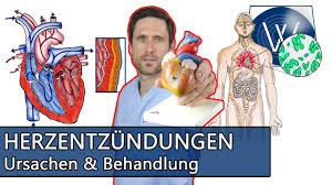Maybe you would like to learn more about one of these? Lebensgefahr Herzmuskelentzundung Wenn Durch Viren Stress Und Erkaltung Das Herz Beschadigt Wird Youtube