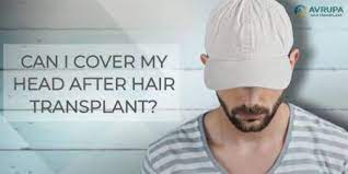 How To Cover Your Head After Hair Transplant The Types Of Hats You Can Wear Avrupa Sac Ekimi Clinic