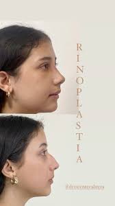 Vicente Cabrera 在 Instagram