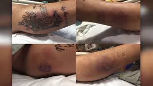 Court spokeswoman maja kovacevic said the transfer conditions had been met. Man Dies After Swimming With New Tattoo In Gulf Of Mexico