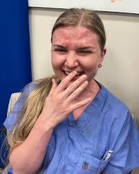 U of Utah Plastic Surgery