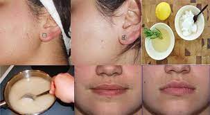 Lemon juice and sugar this is an ancient beauty technique to remove unwanted hair. Home Remedies To Remove Unwanted Chin Hair Life Care Videos Facial Hair Facial Hair Removal Unwanted Facial Hair