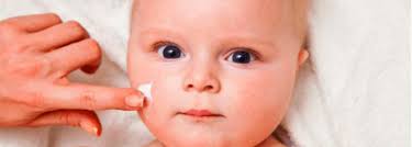 Adalah penyakit mata yang terjadi pada bayi yang baru lahir karena ibunya menderita gonorrhoe. Eksema Tiada Ubat Penyembuh Tapi Ada Cara Untuk Merawatnya Columbia Asia Hospital Malaysia
