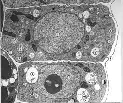 Plant cell under the microscope. Biology 130 Lab 3 Electron Micrographs