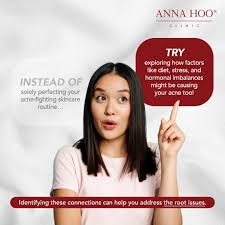 🤔 Did you know your acne could be more than just a skin issue? Different  breakout zones