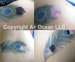 Soaking your tattoo in salt water, in fact, will only cause the ink to disperse, run, or possibly fade. Tattoo Removal Non Laser Proskin Clinic Adelaide Cbd Country Sa