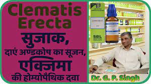 Clematis erecta 30 uses in hindi. à¤• à¤² à¤® à¤Ÿ à¤¸ à¤‡à¤° à¤• à¤Ÿ Clematis Erecta In Hindi Homeopathic Medicine And Treatment In Hindi