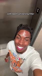 The Whitest Teeth In The World Or Are They Learnontiktok Tiktokpartner Teethwhitening
