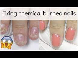 extremely damaged nail transformation how to fix it with polygel youtube nails acrylic nail shapes damaged nails