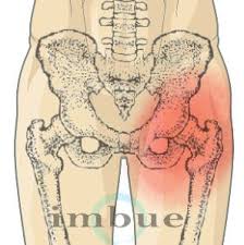 Pin On Pain