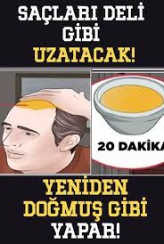 Sac Dokulmesi Duracak Ve Yeni Saclar Cikacak Sac Dokulmesi Sac Uzatma Sac