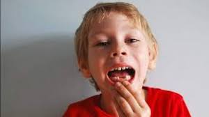 Arti mimpi gigi patah memang identik dengan kesialan dan musibah. 5 Arti Mimpi Gigi Bawah Copot 2 Buah Cintalia Com