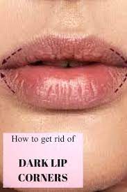 Pin By Ypetsyk On Beauty | Dark Lips, Lips, How To Grow Eyebrows