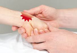 Finkelstein's test is a test used to diagnose de quervain's tenosynovitis in people who have wrist pain. Figure 8 Klinische Untersuchung Des Handgelenkes Und Der Hand Springerlink