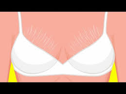 как убрать растяжки на грудях у подростков в домашних условиях Kak Ubrat Rastyazhki Na Kozhe Raz I Navsegda V Domashnih Usloviyah Youtube