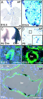 This database of images, including all the routes . Mesothelium Contributes To Vascular Smooth Muscle And Mesenchyme During Lung Development Pnas
