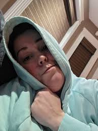 What's worse than catching a cold 🥶 🤧