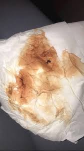 Select from premium period spotting of the highest quality. Implantation Bleeding Tmi Pic Hi There My Period Nct