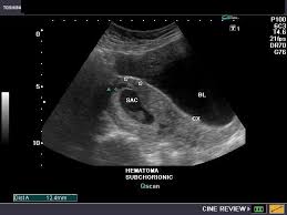 Pin On Ultrasound