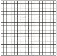 this is an amsler grid it is used to check for changes in