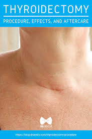What Is Thyroidectomy Procedure Effects And Aftercare There A Number Of Types Of Thyroid Surgeries Depending Thyroidectomy Thyroid Surgery Levothyroxine
