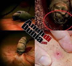 Pohon ini dianggap penting di thailand, khususnya dalam pembuata. Awas Botfly Jenis Lalat Yang Bertelur Di Tubuh Kita Berita Aneh Unik Dan Menarik
