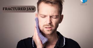 A fractured jaw.